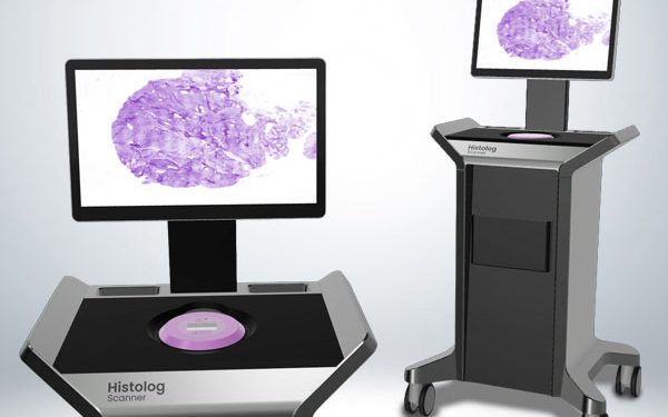 SamanTree – Histolog Scanner