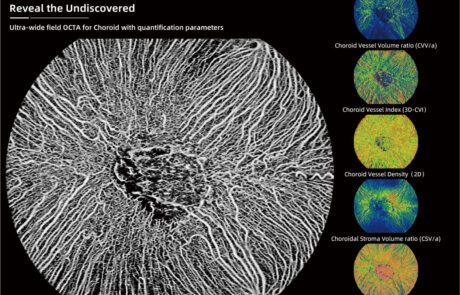 Klinische OCT-Bildgebung