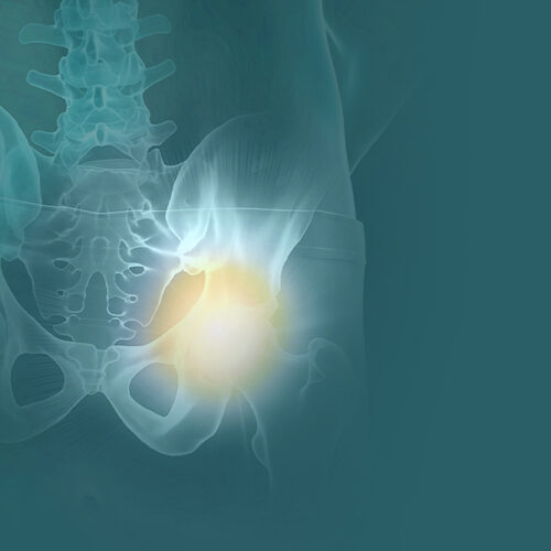 Beckenbodengesundheit