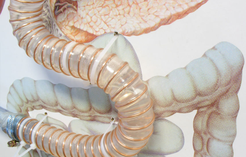 Minimally invasive medical devices