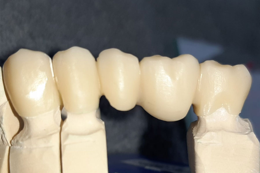Zirconia monolithic