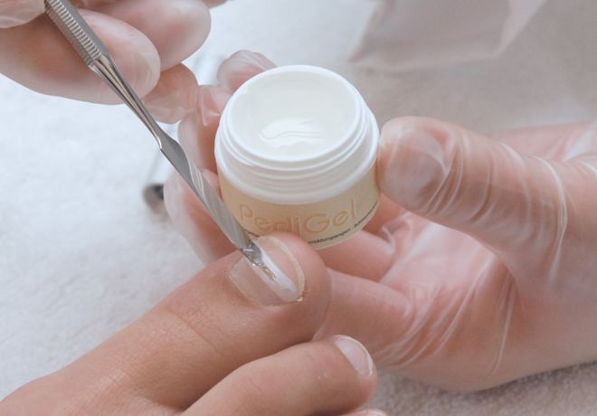 Auftragen von PediGel (UV-Gel) auf den Nagel