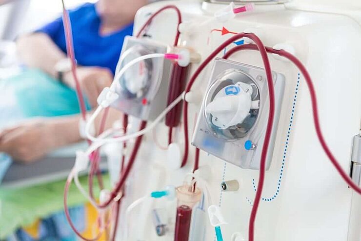 Biokompatible Ventile und Druckminderer, z. B. für Dialyse und Sterilisation