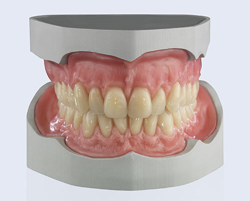 Prosthetics (full ceramic, combination and complete dentures)