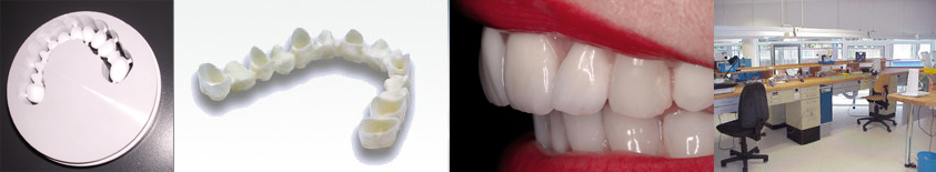Dentaltechnik Kamphoff & Sidon – Fertigung