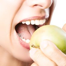 Biocompatible dental prostheses