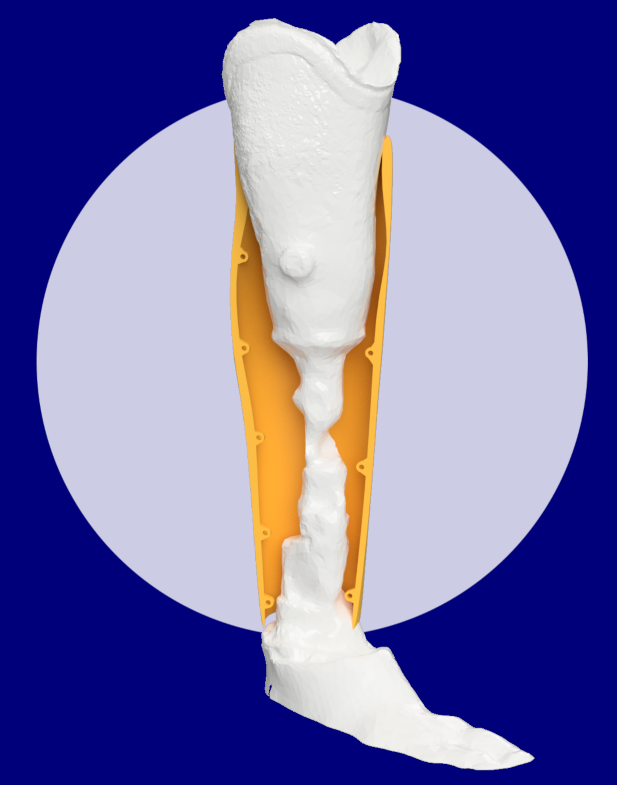 Prothesencover