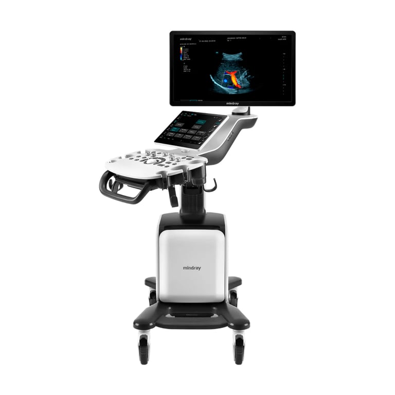 Mindray Consona N6 – Mittelklasse-Ultraschallsystem