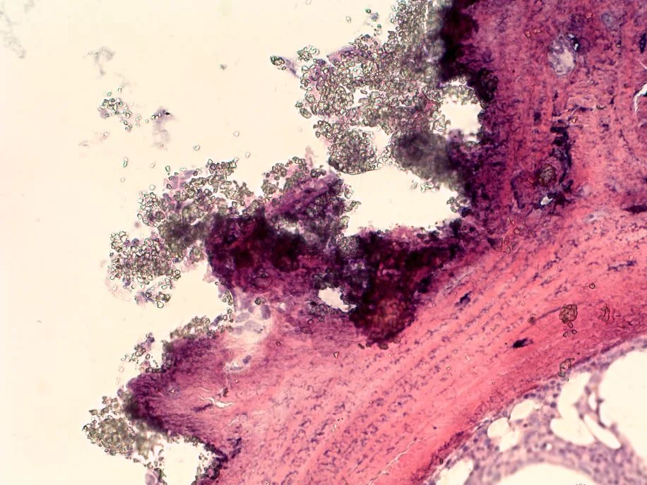 Histologische Biopsie nach RePore-3D-Einsatz (6 Monate, veterinärmedizinisch)