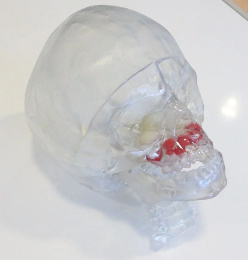 Transluzentes Boneplan-Schädelmodell mit markierten Strukturen