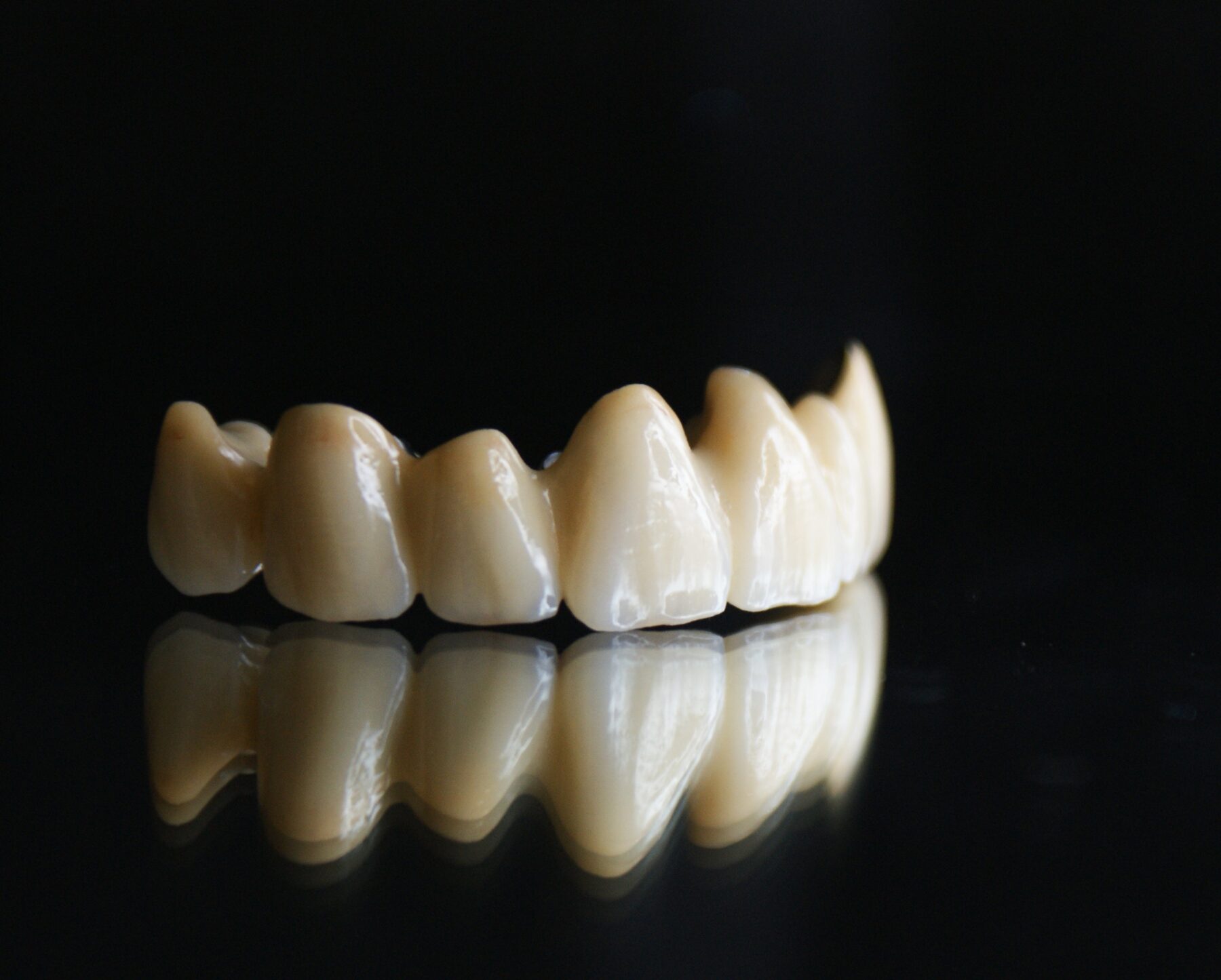Dentallabor Schölch – Fertigung