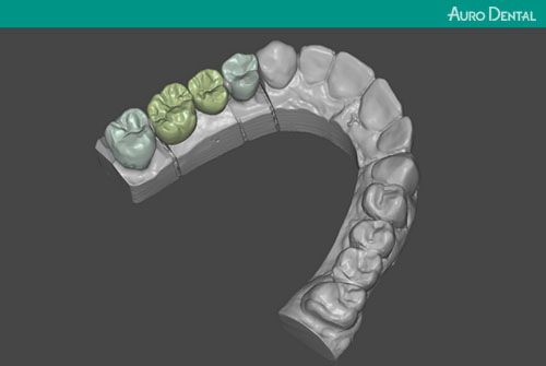 Auro Dental – Fertigung