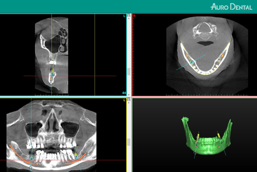 Implantology