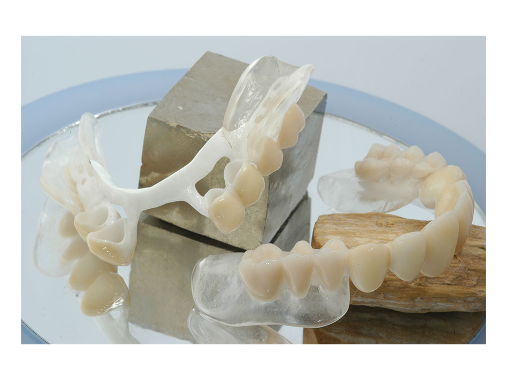 Metal-free removable denture