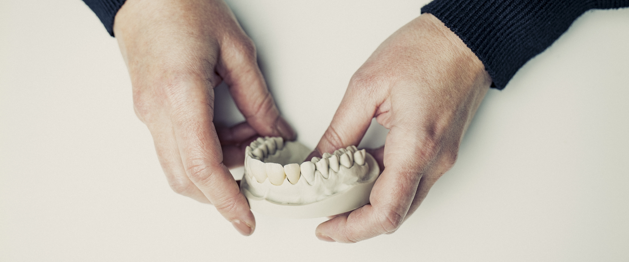 Vollkeramische Kronen, Brücken und Veneers